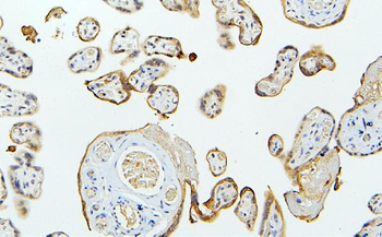 Anti-MID1 Antibody
