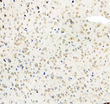 Anti-MID1 Antibody