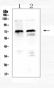 Anti-MID1 Antibody