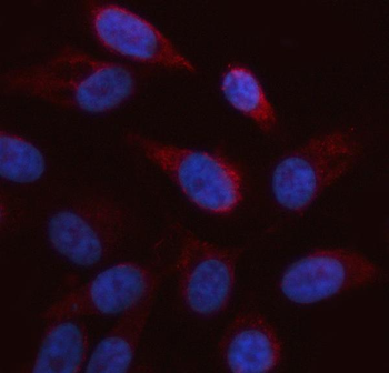 Anti-ARAF Antibody