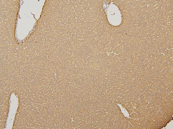 Anti-Cytochrome p450 2C19/CYP2C19 Antibody