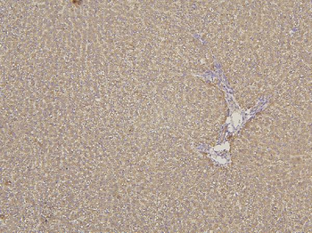 Anti-Cytochrome p450 2C19/CYP2C19 Antibody