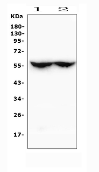 Anti-Cytochrome p450 2C19/CYP2C19 Antibody