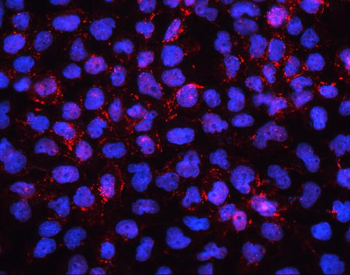 Anti-EHD1 Antibody