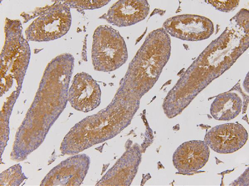 Anti-EHD1 Antibody