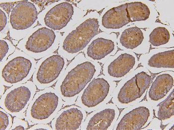 Anti-EHD1 Antibody