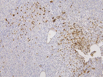 Anti-Glycophorin A/GYPA Antibody