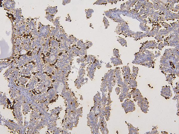 Anti-Glycophorin A/GYPA Antibody
