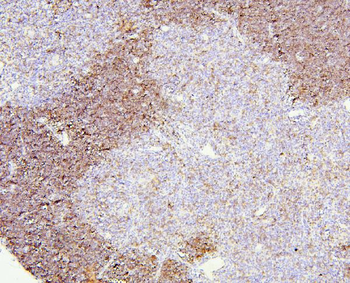 Anti-CD8 alpha/Cd8a Antibody