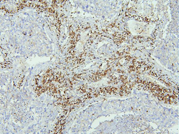 Anti-EBP50/NHERF-1/SLC9A3R1 Antibody