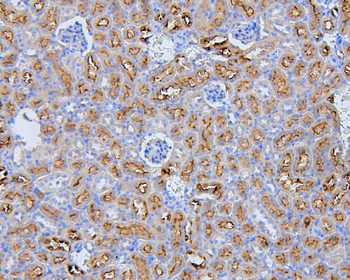 Anti-EBP50/NHERF-1/SLC9A3R1 Antibody