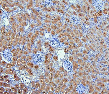 EBP50/NHERF-1/SLC9A3R1 Antibody