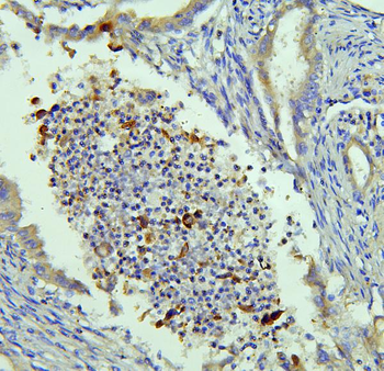 Anti-NRAMP1/SLC11A1 Antibody
