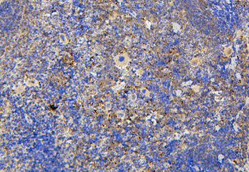 Anti-NRAMP1/SLC11A1 Antibody