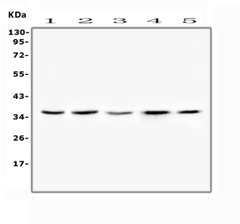 FRZB Rabbit Polyclonal Antibody