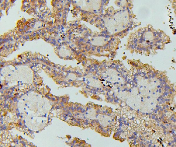 Anti-SGLT2/SLC5A2 Antibody