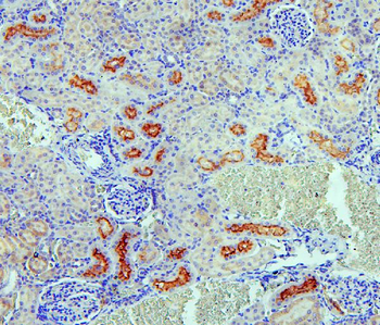 Anti-SGLT2/SLC5A2 Antibody