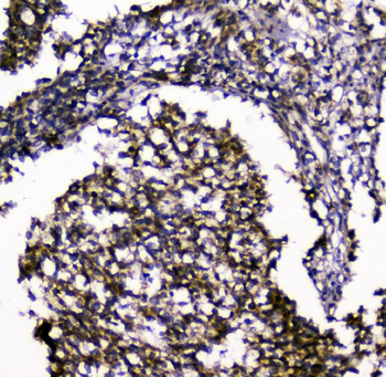 Anti-SIRT4 Antibody