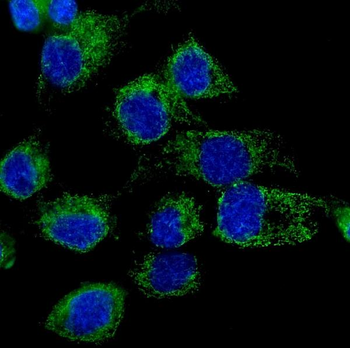 Anti-LONP1/Lon Antibody