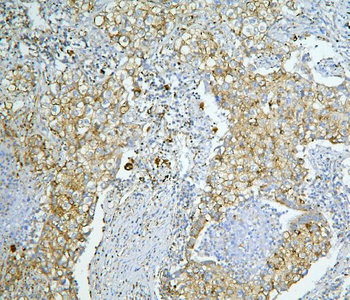 Anti-LONP1/Lon Antibody