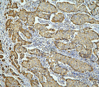 Anti-LONP1/Lon Antibody