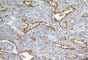 Anti-LONP1/Lon Antibody