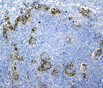 Anti-SLC34A2 Antibody