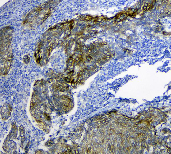 Anti-SLC34A2 Antibody