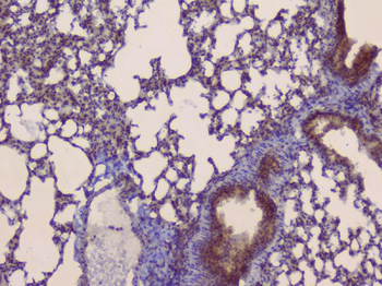 Anti-SLC34A2 Antibody