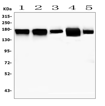 Anti-MTUS1 Antibody