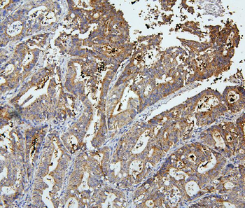 Anti-OLFM4 Antibody