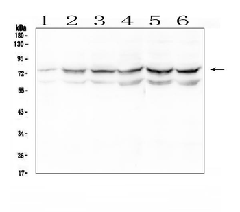 Anti-OLFM4 Antibody