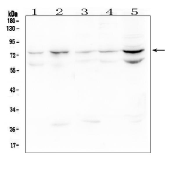 Anti-OLFM4 Antibody