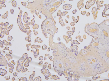 Anti-KCC2/SLC12A5 Antibody