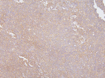 Anti-KCC2/SLC12A5 Antibody