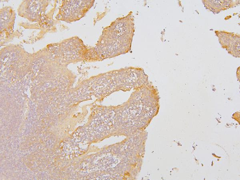 Anti-KCC2/SLC12A5 Antibody