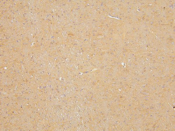 Anti-KCC2/SLC12A5 Antibody