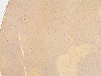 Anti-KCC2/SLC12A5 Antibody