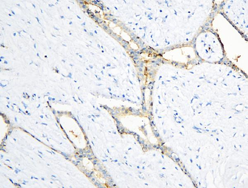 Anti-Annexin A3/ANXA3 Antibody