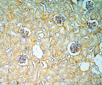 Anti-Annexin A3/ANXA3 Antibody