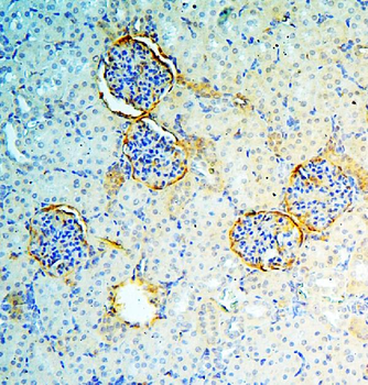Anti-Annexin A3/ANXA3 Antibody