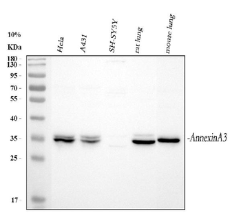 Anti-Annexin A3/ANXA3 Antibody