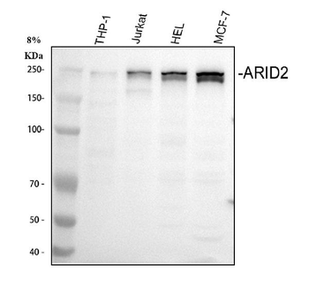 Anti-ARID2 Antibody