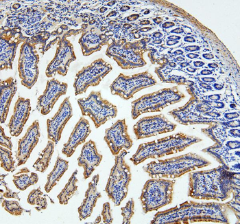 Anti-Loricrin/LOR Antibody