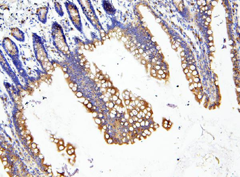 Anti-Loricrin/LOR Antibody