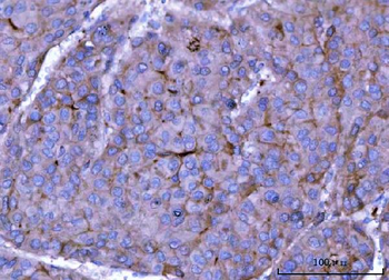 Anti-ch TOG/CKAP5 Antibody