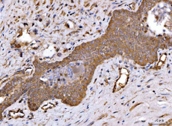Anti-ch TOG/CKAP5 Antibody
