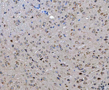 ch TOG/CKAP5 Antibody