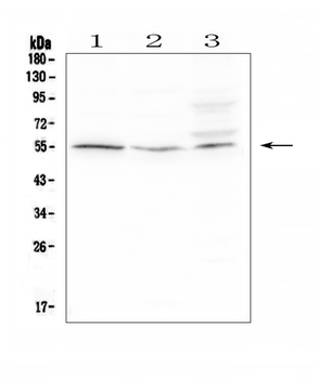 Anti-D6/ACKR2 Antibody