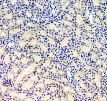 Anti-BCL9L Antibody